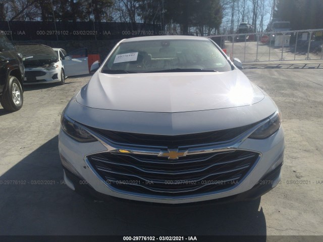 Photo 5 VIN: 1G1ZD5ST0LF074383 - CHEVROLET MALIBU 