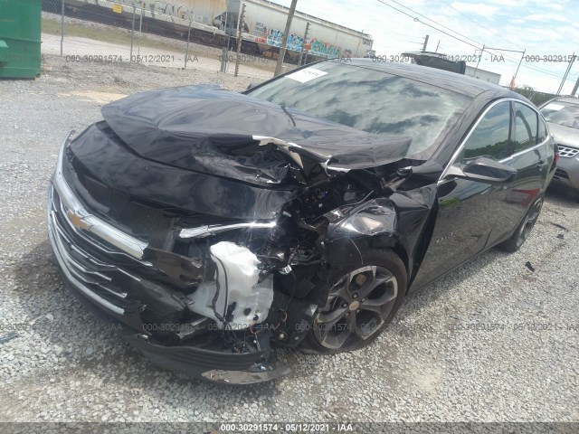 Photo 1 VIN: 1G1ZD5ST0LF100917 - CHEVROLET MALIBU 