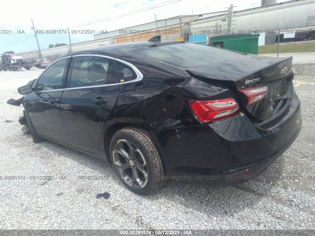 Photo 2 VIN: 1G1ZD5ST0LF100917 - CHEVROLET MALIBU 