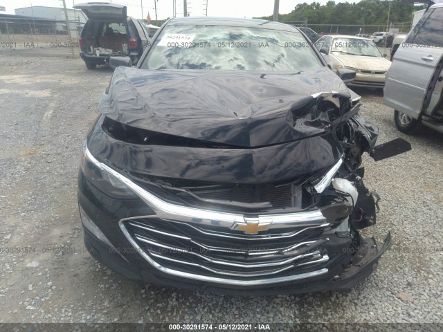 Photo 5 VIN: 1G1ZD5ST0LF100917 - CHEVROLET MALIBU 