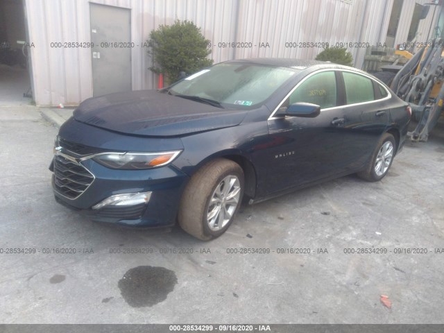 Photo 1 VIN: 1G1ZD5ST0LF102540 - CHEVROLET MALIBU 