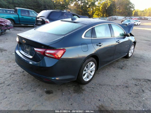 Photo 3 VIN: 1G1ZD5ST0LF152211 - CHEVROLET MALIBU 