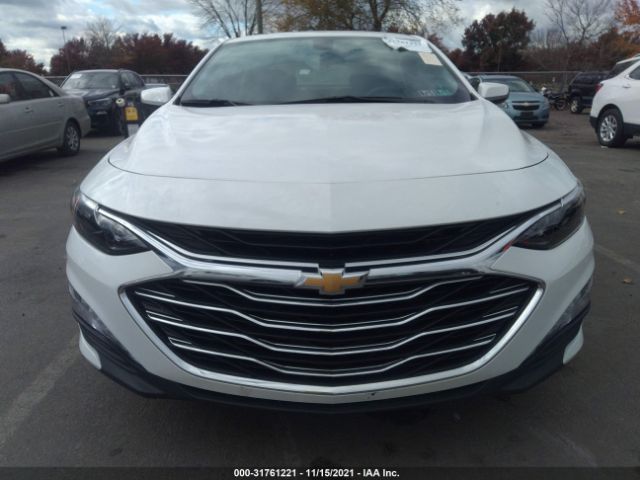 Photo 5 VIN: 1G1ZD5ST0MF003878 - CHEVROLET MALIBU 