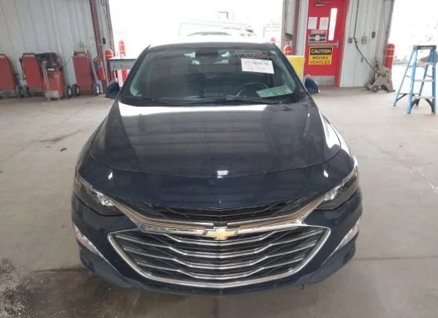 Photo 5 VIN: 1G1ZD5ST0NF111807 - CHEVROLET MALIBU 