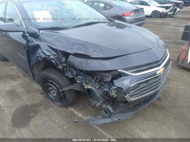 Photo 5 VIN: 1G1ZD5ST1JF104147 - CHEVROLET MALIBU 