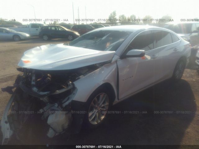 Photo 1 VIN: 1G1ZD5ST1JF123295 - CHEVROLET MALIBU 