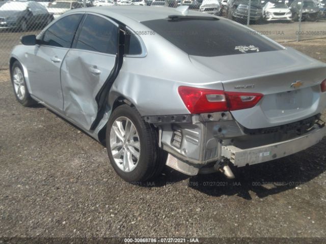 Photo 5 VIN: 1G1ZD5ST1JF175641 - CHEVROLET MALIBU 