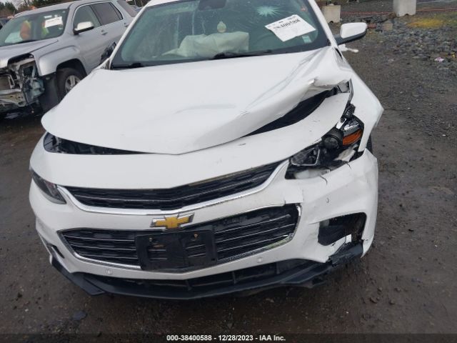 Photo 5 VIN: 1G1ZD5ST1JF201803 - CHEVROLET MALIBU 