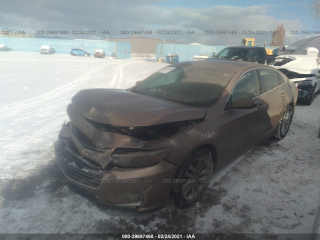 Photo 1 VIN: 1G1ZD5ST1JF239371 - CHEVROLET MALIBU 