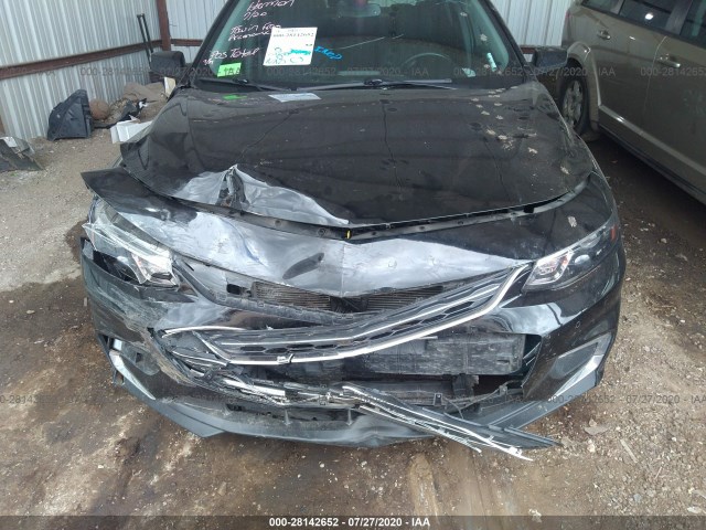 Photo 5 VIN: 1G1ZD5ST1JF240908 - CHEVROLET MALIBU 