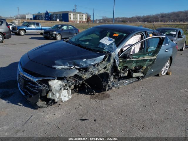 Photo 1 VIN: 1G1ZD5ST1LF078586 - CHEVROLET MALIBU 