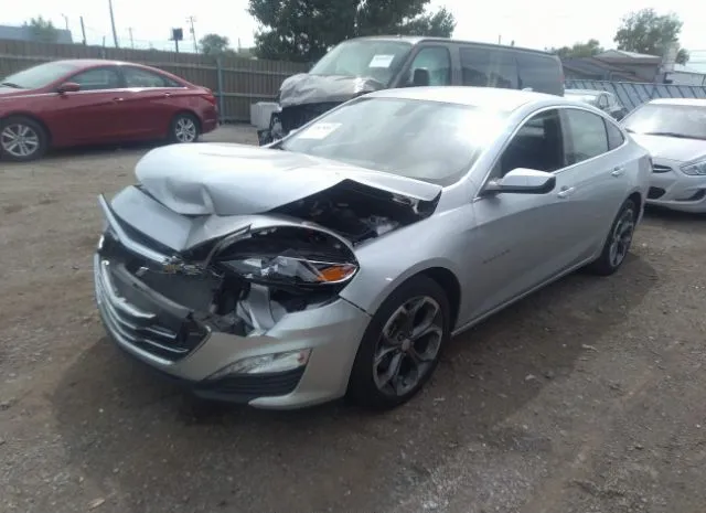 Photo 1 VIN: 1G1ZD5ST1LF108377 - CHEVROLET MALIBU 