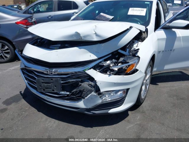 Photo 5 VIN: 1G1ZD5ST1LF109741 - CHEVROLET MALIBU 