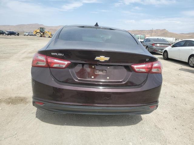 Photo 5 VIN: 1G1ZD5ST1LF123302 - CHEVROLET MALIBU LT 