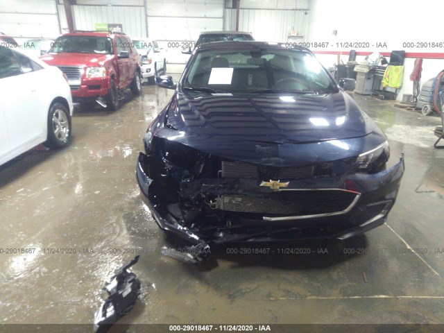 Photo 5 VIN: 1G1ZD5ST2JF187426 - CHEVROLET MALIBU 