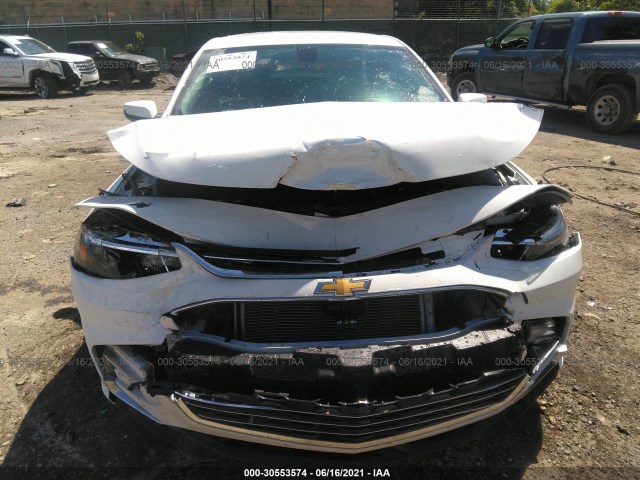 Photo 5 VIN: 1G1ZD5ST2JF225625 - CHEVROLET MALIBU 