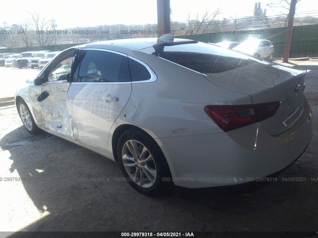 Photo 2 VIN: 1G1ZD5ST2JF243770 - CHEVROLET MALIBU 