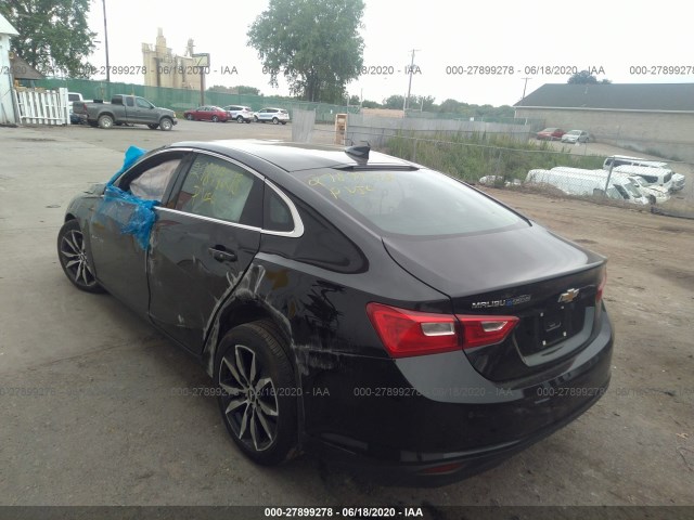 Photo 2 VIN: 1G1ZD5ST2JF290510 - CHEVROLET MALIBU 