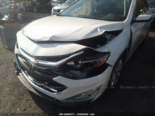 Photo 5 VIN: 1G1ZD5ST2KF155139 - CHEVROLET MALIBU 