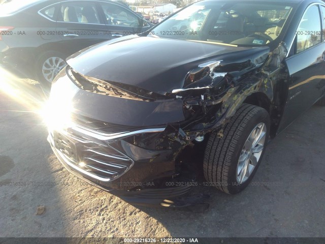 Photo 5 VIN: 1G1ZD5ST2KF204601 - CHEVROLET MALIBU 