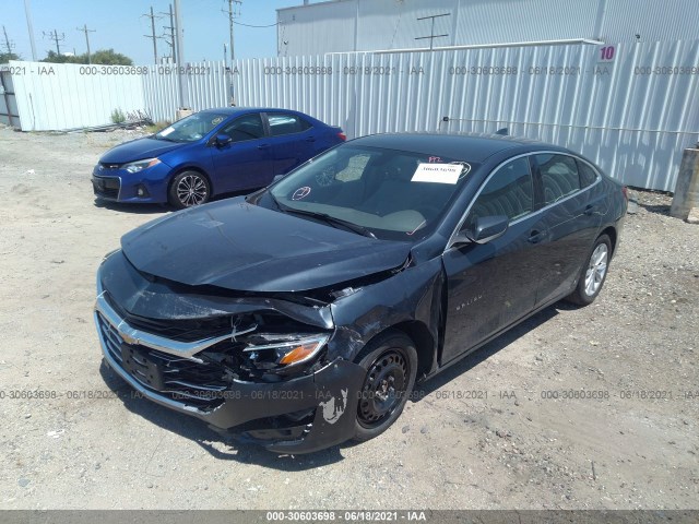 Photo 1 VIN: 1G1ZD5ST2LF043443 - CHEVROLET MALIBU 