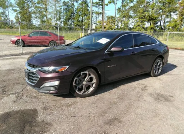 Photo 1 VIN: 1G1ZD5ST2MF028376 - CHEVROLET MALIBU 