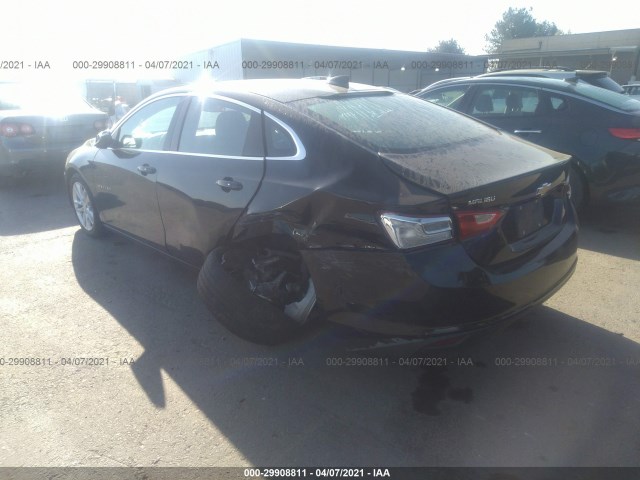 Photo 2 VIN: 1G1ZD5ST3JF138865 - CHEVROLET MALIBU 