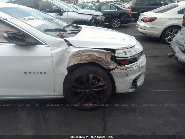 Photo 5 VIN: 1G1ZD5ST3JF240795 - CHEVROLET MALIBU 