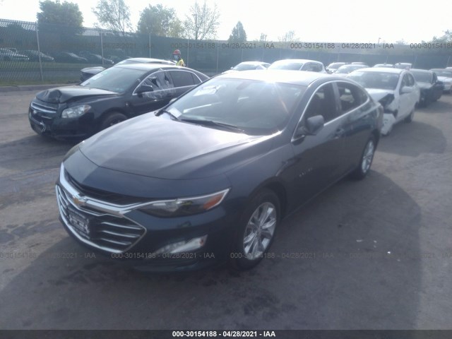 Photo 1 VIN: 1G1ZD5ST3LF006921 - CHEVROLET MALIBU 