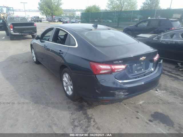 Photo 2 VIN: 1G1ZD5ST3LF006921 - CHEVROLET MALIBU 