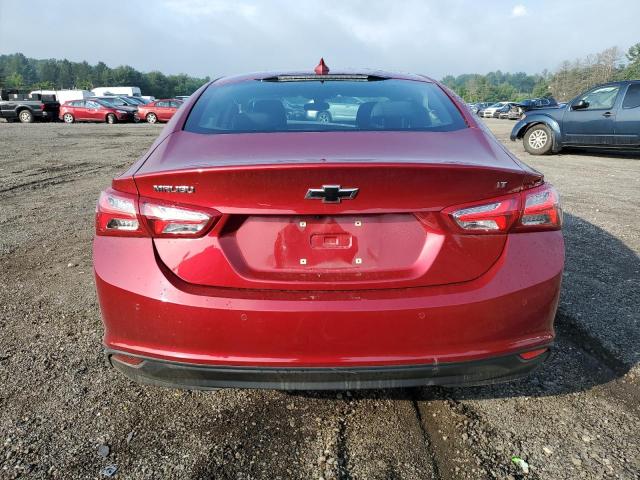 Photo 5 VIN: 1G1ZD5ST3LF018227 - CHEVROLET MALIBU 