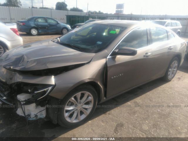 Photo 1 VIN: 1G1ZD5ST3LF056251 - CHEVROLET MALIBU 