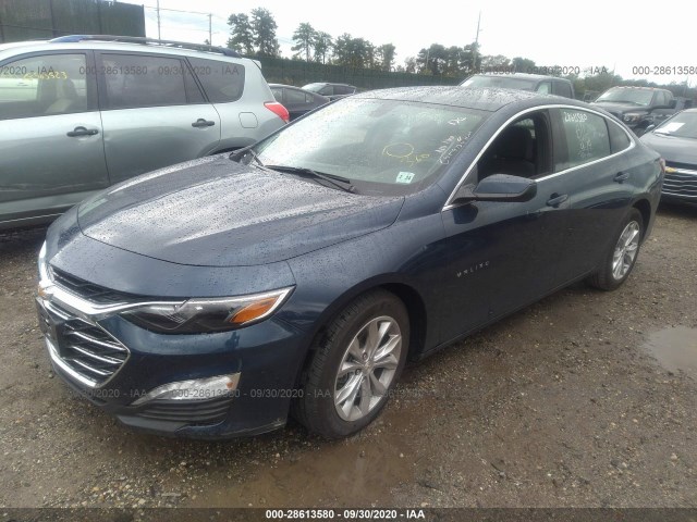 Photo 1 VIN: 1G1ZD5ST3LF086589 - CHEVROLET MALIBU 