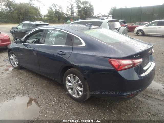 Photo 2 VIN: 1G1ZD5ST3LF086589 - CHEVROLET MALIBU 