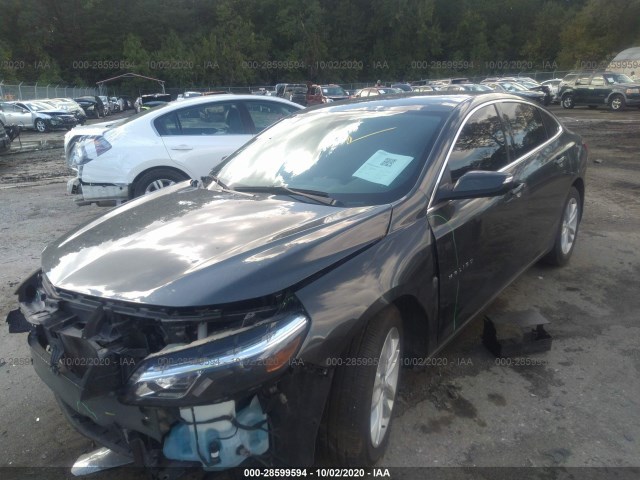 Photo 1 VIN: 1G1ZD5ST4JF167906 - CHEVROLET MALIBU 