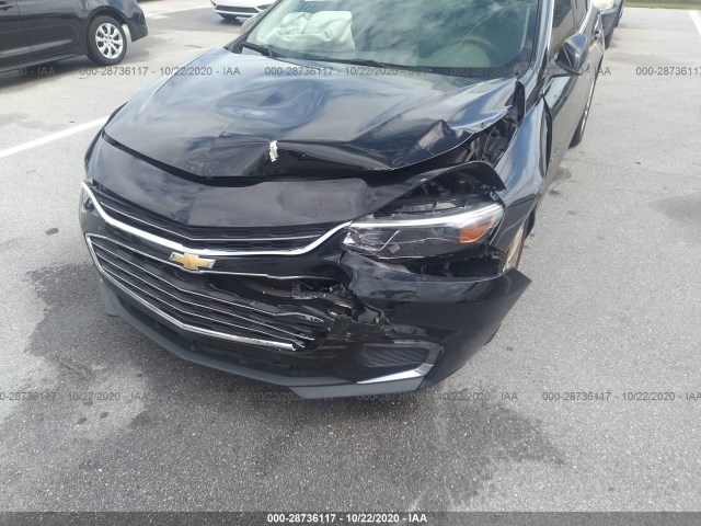 Photo 5 VIN: 1G1ZD5ST4JF201830 - CHEVROLET MALIBU 