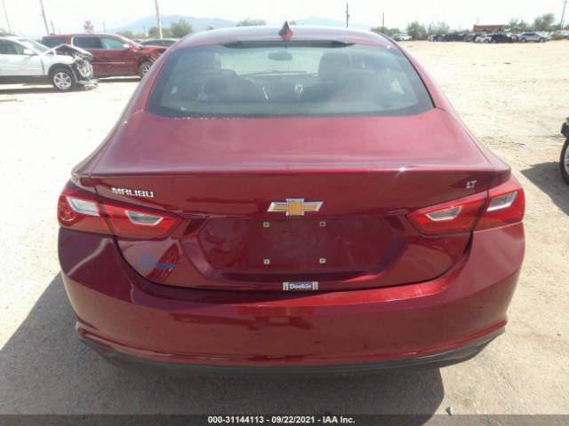 Photo 5 VIN: 1G1ZD5ST4JF202668 - CHEVROLET MALIBU 