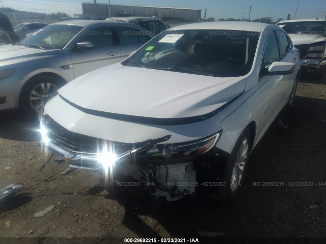 Photo 1 VIN: 1G1ZD5ST4LF067324 - CHEVROLET MALIBU 