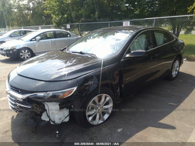 Photo 1 VIN: 1G1ZD5ST4LF095169 - CHEVROLET MALIBU 