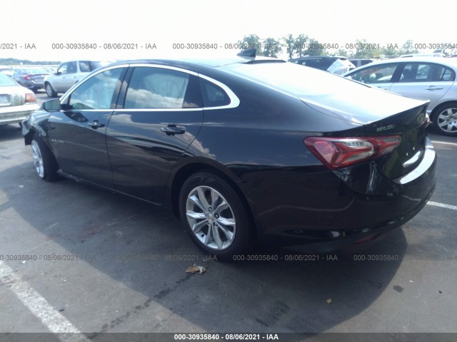 Photo 2 VIN: 1G1ZD5ST4LF095169 - CHEVROLET MALIBU 