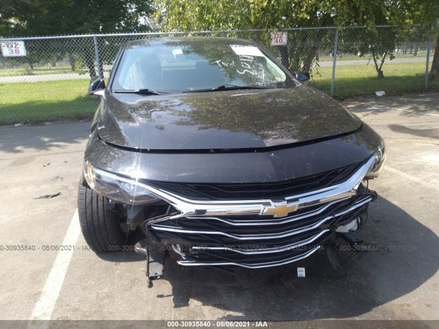 Photo 5 VIN: 1G1ZD5ST4LF095169 - CHEVROLET MALIBU 