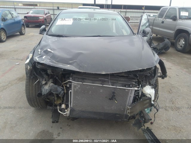 Photo 5 VIN: 1G1ZD5ST4LF117266 - CHEVROLET MALIBU 