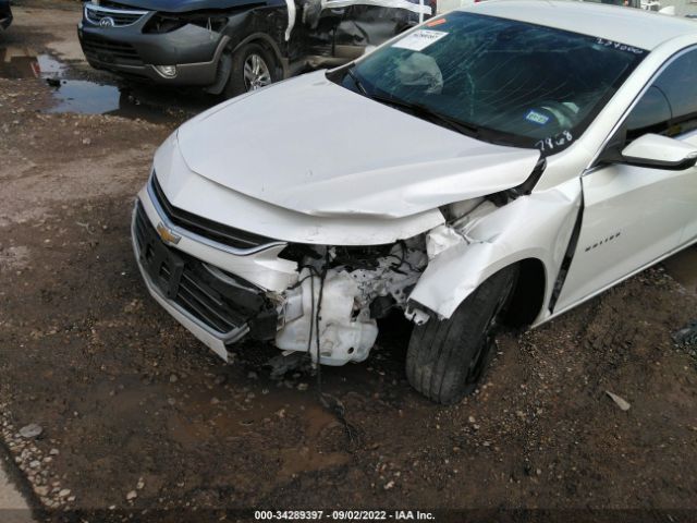 Photo 5 VIN: 1G1ZD5ST5JF157868 - CHEVROLET MALIBU 