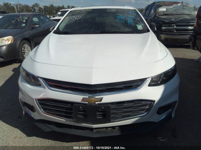 Photo 5 VIN: 1G1ZD5ST5JF173133 - CHEVROLET MALIBU 