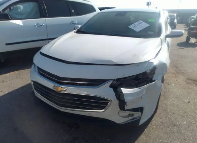 Photo 5 VIN: 1G1ZD5ST5JF291022 - CHEVROLET MALIBU 