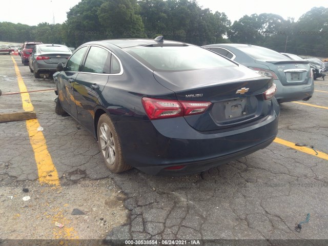 Photo 2 VIN: 1G1ZD5ST5LF062911 - CHEVROLET MALIBU 