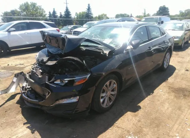 Photo 1 VIN: 1G1ZD5ST5LF077571 - CHEVROLET MALIBU 