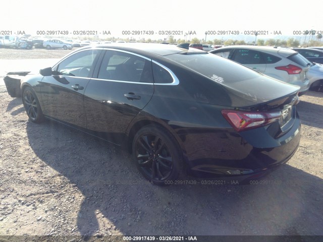 Photo 2 VIN: 1G1ZD5ST5LF081779 - CHEVROLET MALIBU 