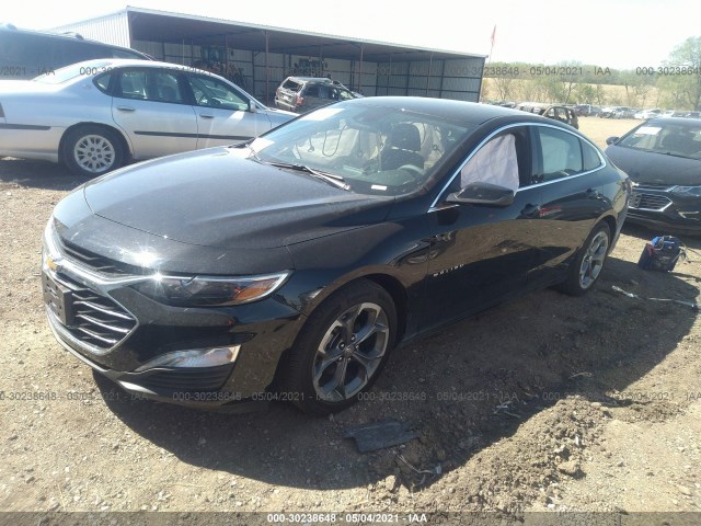 Photo 1 VIN: 1G1ZD5ST5LF157243 - CHEVROLET MALIBU 