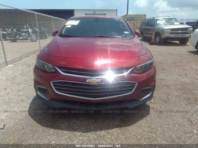 Photo 5 VIN: 1G1ZD5ST6JF139332 - CHEVROLET MALIBU 